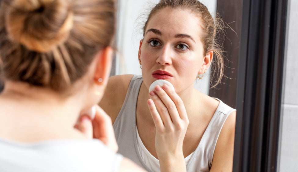 How Can You Minimize Acne Breakouts by Changing Your Diet?