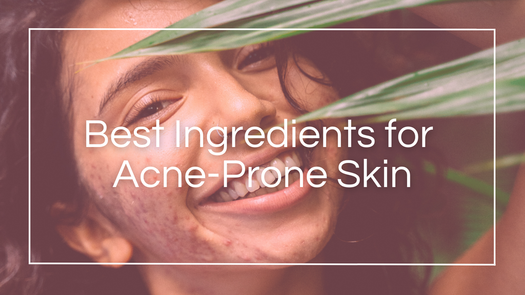 The Best Ingredients for Acne-Prone Skin: How to Choose Products That *Actually* Work